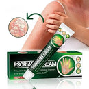 Psoriasis Cream - Herbal Plant Extracts
