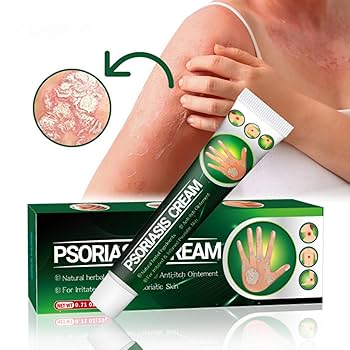 Psoriasis Cream - Herbal Plant Extracts